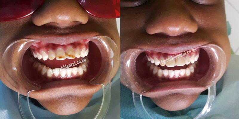 Emerald dental Clinic Nairobi